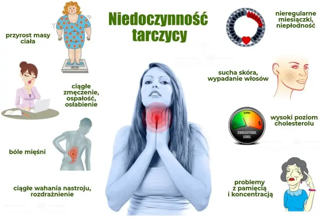 Niedoczynność tarczycy - objawy, badania i leczenie